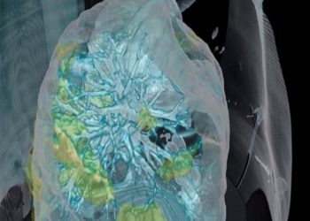 كل ما تريد معرفته …عن ما يسببه كورونا من نقص الاكسجين فى الدم