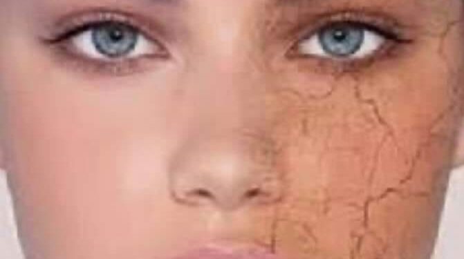 رحلة فى عالم البشرة الجافة