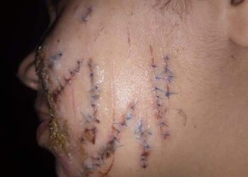 اين ذهبت قلوب البشر اب يعذب ابنتة بابشع صور العذاب دون رحمة