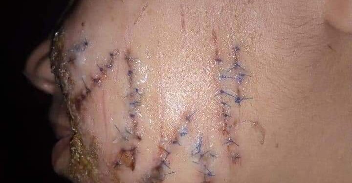 اين ذهبت قلوب البشر اب يعذب ابنتة بابشع صور العذاب دون رحمة