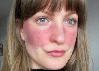 تعاملى بسلاسه مع البشره الحساسه