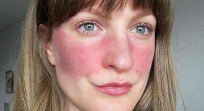 تعاملى بسلاسه مع البشره الحساسه