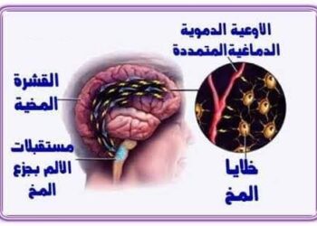 الإضطرابات السيكوسوماتية