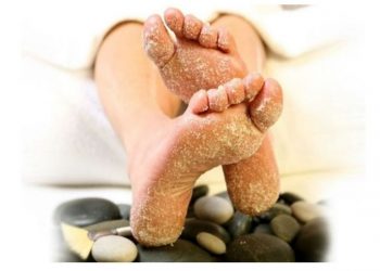 وصفات طبيعية لتقشير القدمين فى المنزل