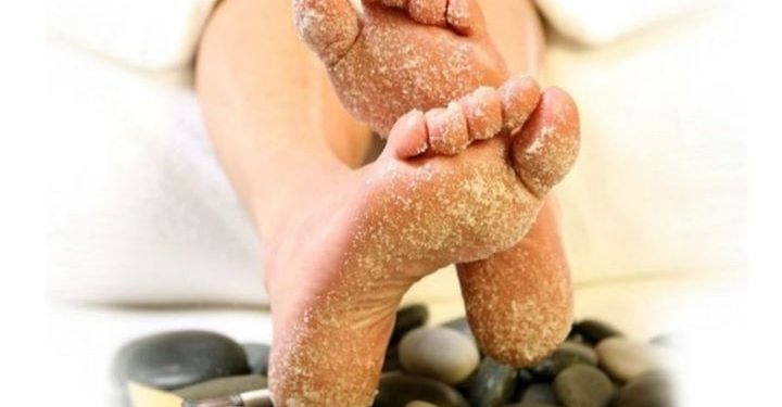 وصفات طبيعية لتقشير القدمين فى المنزل