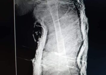 مستشفى النجيلة الصرح العظيم بمحافظة مطروح بعد إنجازها فى مهامها من جائحه كورنا