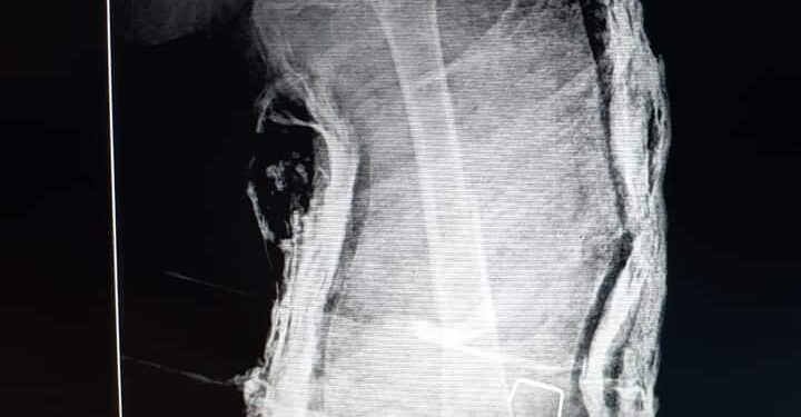 مستشفى النجيلة الصرح العظيم بمحافظة مطروح بعد إنجازها فى مهامها من جائحه كورنا