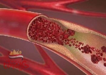 تعرف على كيفية ارتفاع الكوليسترول عند الإنسان