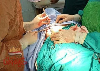 إجراء عملية تجميل أنف بمركز ههيا للحروق والجراحات التكميلية للمرة الأولي