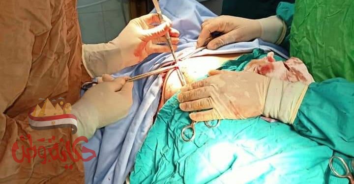 إجراء عملية تجميل أنف بمركز ههيا للحروق والجراحات التكميلية للمرة الأولي