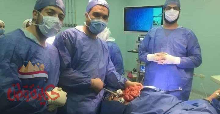 مركز اورام ميت غمر وتطور فى جراحة المناظير لاورام القولون