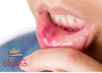 علاجات منزلية