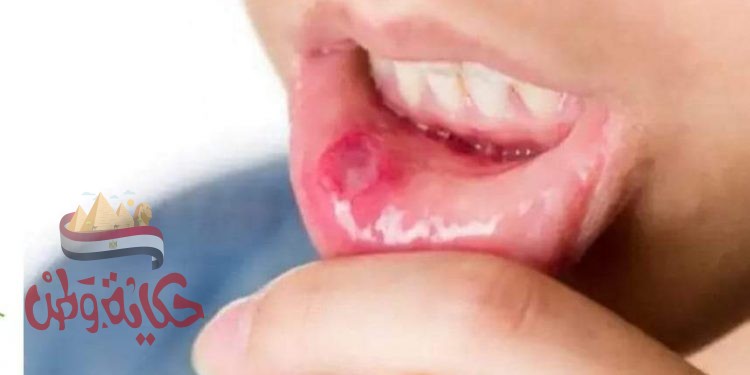 علاجات منزلية