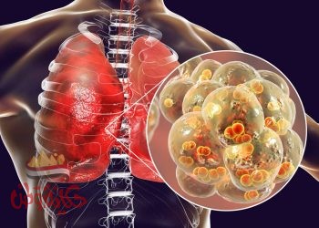 وباء جديد يسبب ازمة عالمية ثانية