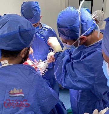 جامعة حلوان: نجاح الفريق الطبي بمستشفى بدر الجامعي بإجراء جراحة في المخ لمريضة في ٣ ساعات