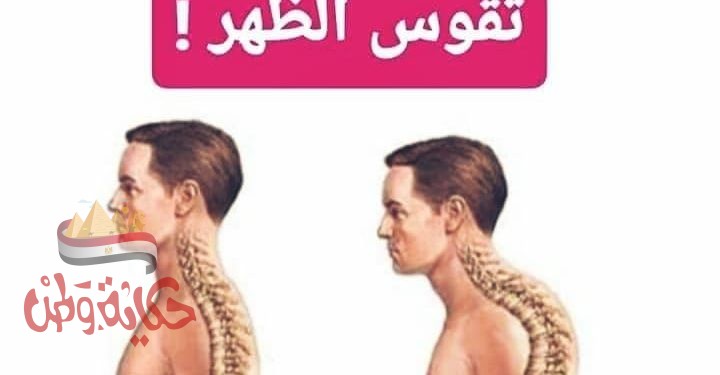 تقوس الظهر و أسبابه وأعراضه وطرق الوقاية والعلاج
