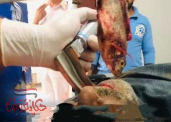 أغرب حادثة : صياد  أبتلع سمكة حية أدت لاختناقه