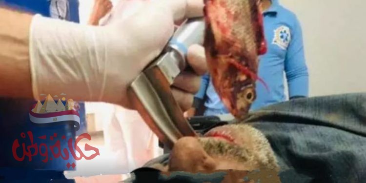 أغرب حادثة : صياد أبتلع سمكة حية أدت لاختناقه