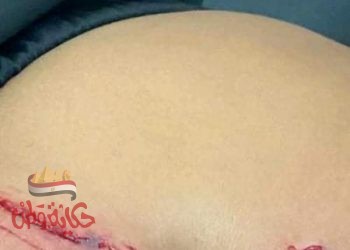 أحشاء طفل نهشتها كلاب فوق القانون