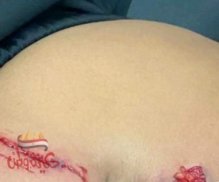 أحشاء طفل نهشتها كلاب فوق القانون