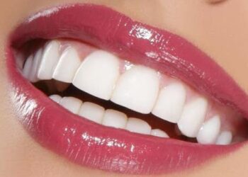 هوليود سمايل