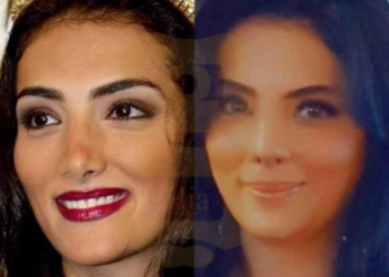 بعد نجاح جراحة التجميل حورية فرغلي تعلن موعد عودتها للقاهره