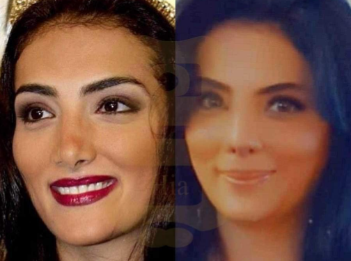 بعد نجاح جراحة التجميل حورية فرغلي تعلن موعد عودتها للقاهره