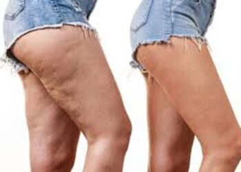 وصفات للتخلص