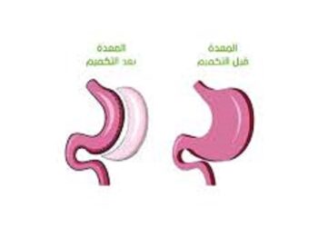 كيف تتم عمليات