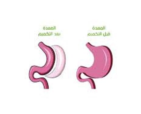 كيف تتم عمليات