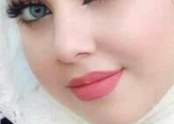 ارجوانية الشفتين