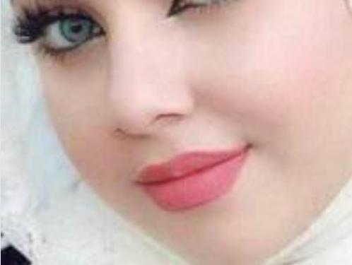 ارجوانية الشفتين