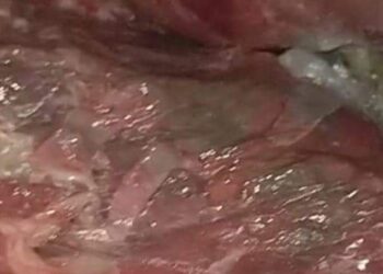 ضبط ٦٩ كيلو لحوم فاسدة غير صالحة للأستهلاك الأدمى داخل مطعم بكفر الزيات مركز طنطا