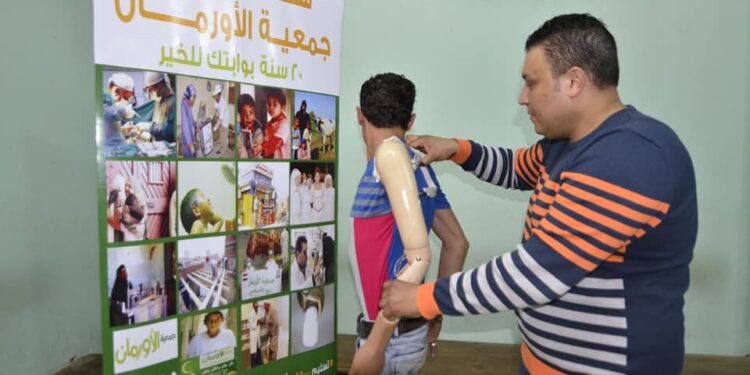 «الأورمان» توزع أطراف صناعية وسماعات أذن لذوي القدرات الخاصة بكفرالشيخ