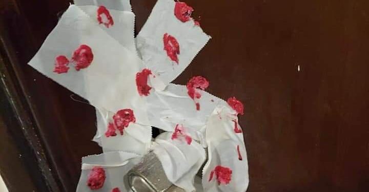 غلق مركز طبي شهير لتفتيت الحصوات بحي أول طنطا.