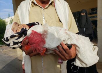 بن مبارك :ميليشيا الحوثي أصبحت أكثر دموية ضد المدنيين