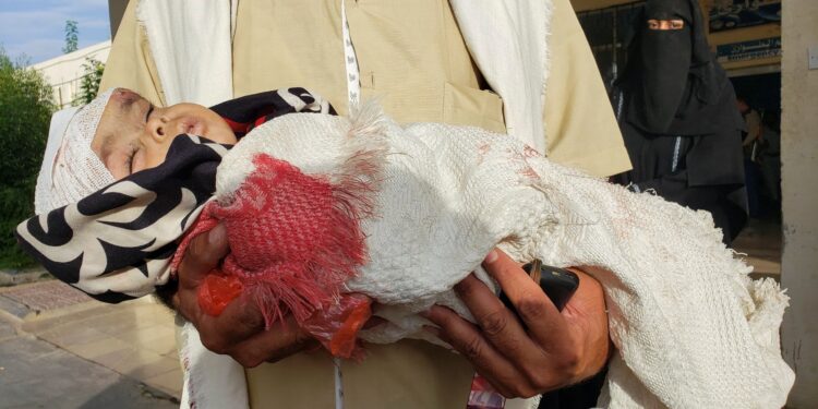 بن مبارك :ميليشيا الحوثي أصبحت أكثر دموية ضد المدنيين