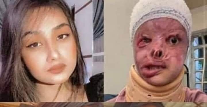 مريم الركابي طالبة تشوه وجهها بسبب شاب فى العراق.