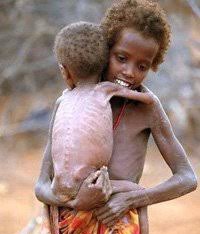 الصومال… 300 ألف طفل دون الخامسة ..يواجهون الموت