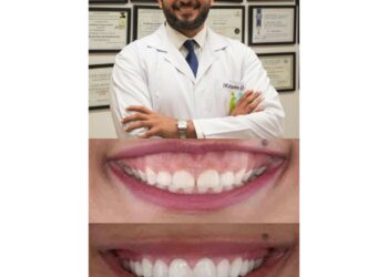 الإبتسامة اللثوية وطرق علاجها والتخلص منها