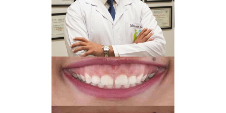 الإبتسامة اللثوية وطرق علاجها والتخلص منها