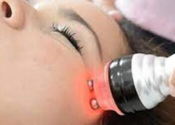 الليزر لعلاج حب