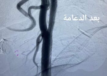 مستشفى قنا العام تصنع الإعجاز بإنجاز. 