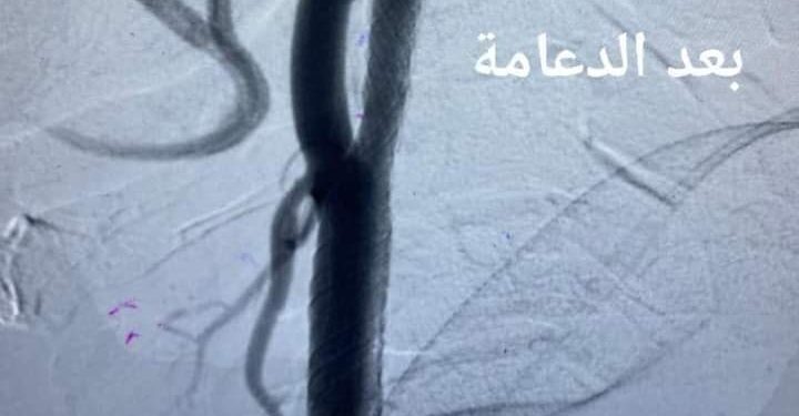 مستشفى قنا العام تصنع الإعجاز بإنجاز. 