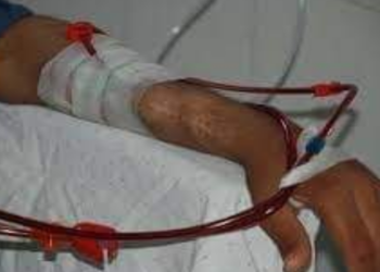 مستشفي ابوتشت المركزي تعاقب مرضي الغسيل الكلوي