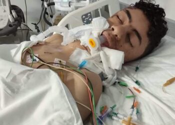 إصابة طالب نتيجة تهور شاب بسيارته ودخوله في غيبوبة طويلة