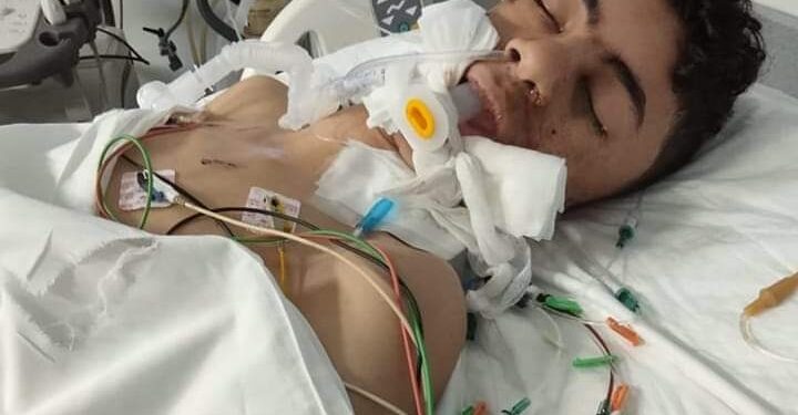 إصابة طالب نتيجة تهور شاب بسيارته ودخوله في غيبوبة طويلة