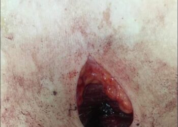 بلطجي ابو جريدة يعتدي على سيدة أمام أطفالها ويمزق أجسادهما بالسلاح الأبيض في دمياط. 