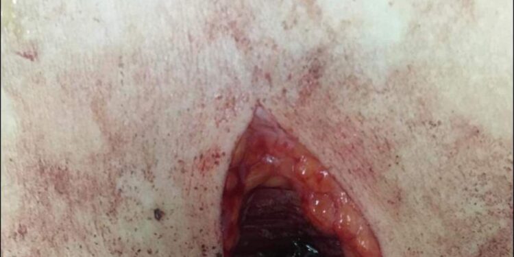 بلطجي ابو جريدة يعتدي على سيدة أمام أطفالها ويمزق أجسادهما بالسلاح الأبيض في دمياط.