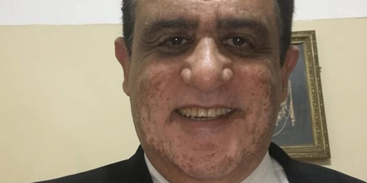 النصب المالي في مصر